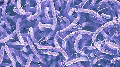 Kolera Nedir? Belirtileri Nelerdir? Nasıl Tedavi Edilir?