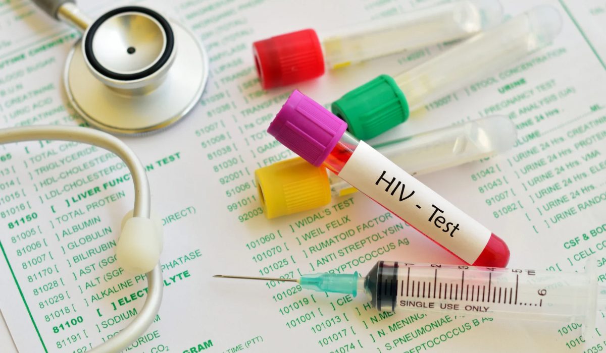 AIDS Testi Neden Yapılır? Kimler Test Yaptırmalı?